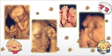 3D＆4D超音波写真によるおなかの中の赤ちゃんの様子
